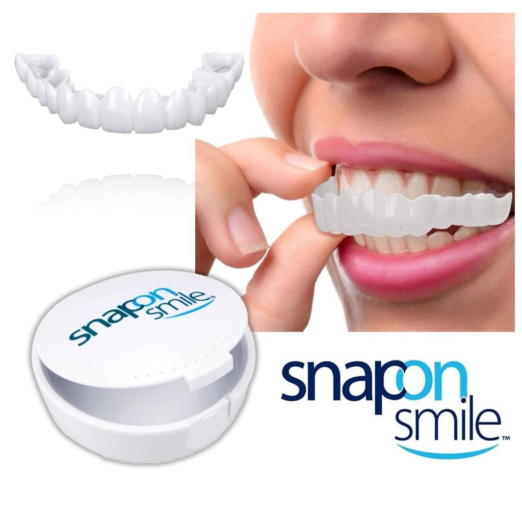 😁✨ SnapOn Smile – La Forma Más Fácil de Renovar tu Sonrisa 🦷💎